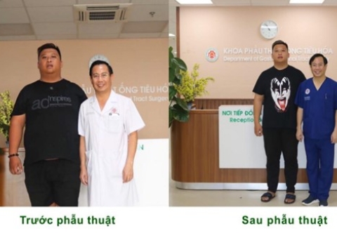 Hành trình cải thiện cân nặng và sức khỏe sau 8 tháng phẫu thuật thu nhỏ dạ dày